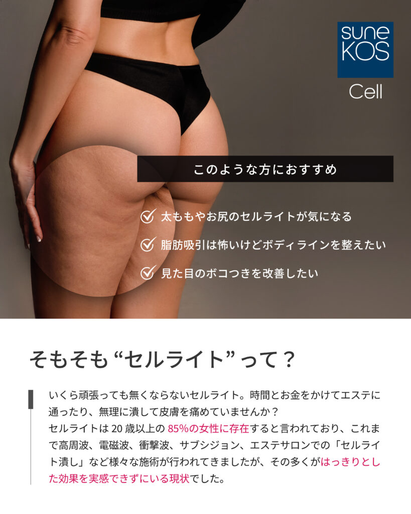 ミニセル〜気になる脂肪のセルライトケアが家庭で出来ちゃう！｜ボディケア