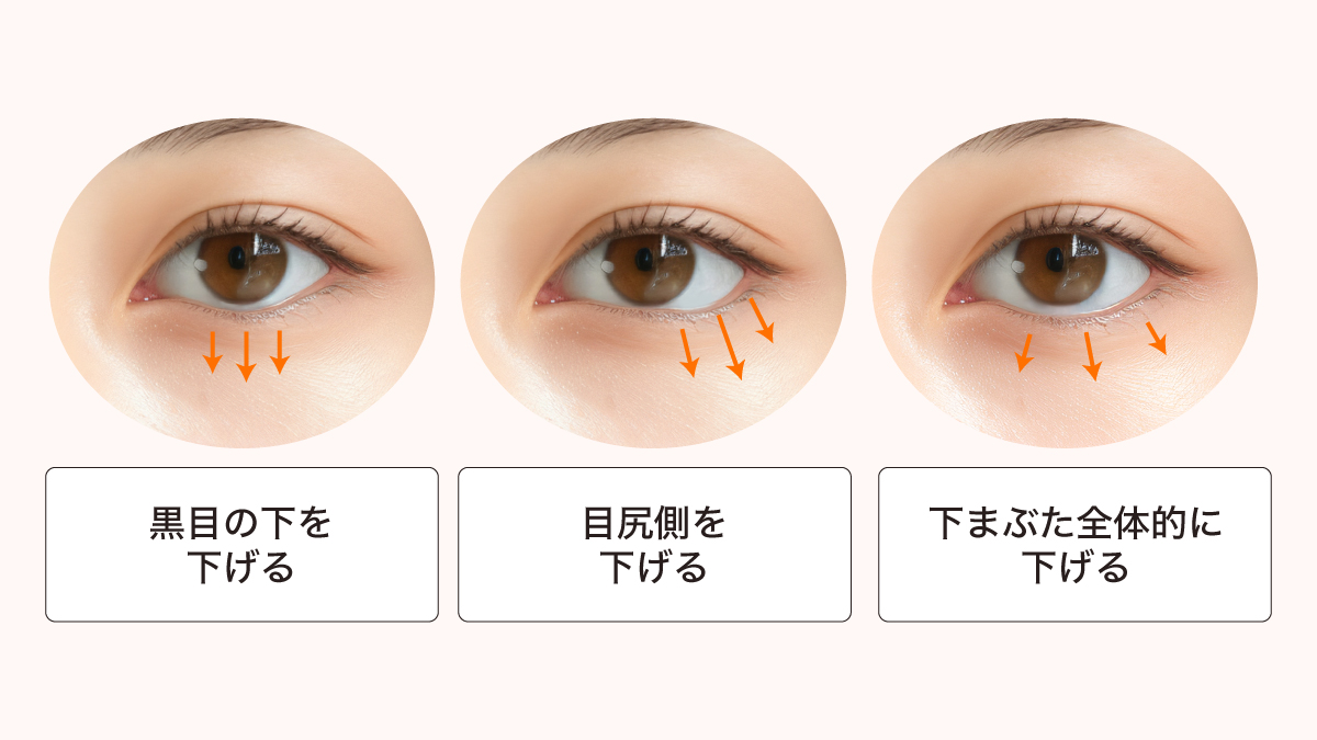 タレ目形成のデザイン